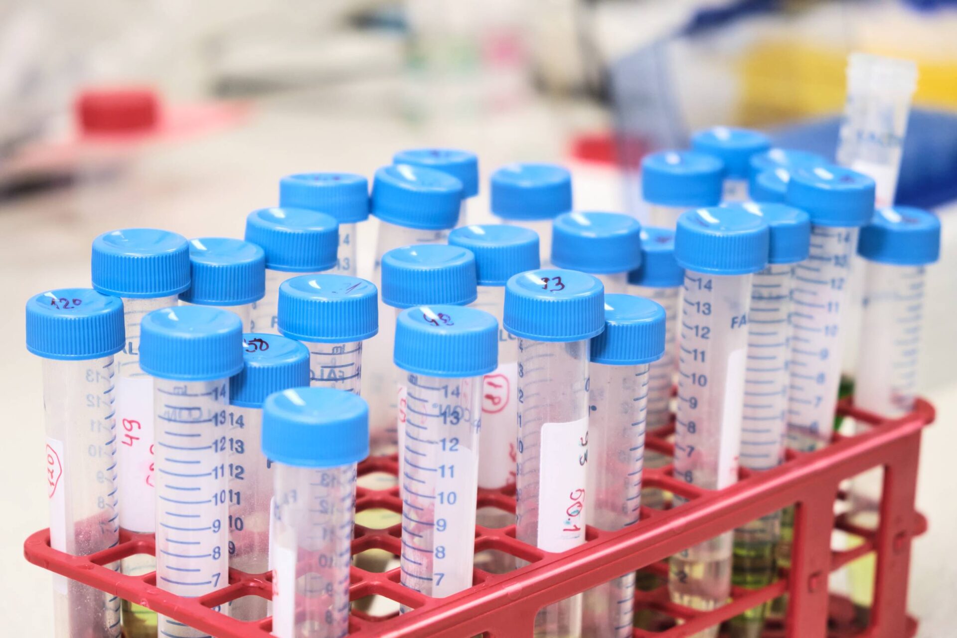 Evcil hayvanlarımız sağlıklı bir yaşam sürdürebilmeleri için düzenli olarak veteriner hekim kontrolünde olmalıdır. Veteriner kliniğimizde sunduğumuz birçok hizmetin yanı sıra, kan tahlili de rutin kontrollerin bir parçasıdır. Kan tahlili, evcil hayvanınızın kanında bulunan maddelerin analiz edilmesini içerir.